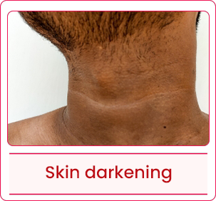 Skin-darkening-wh.png